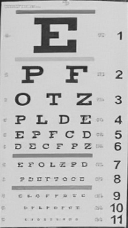 Eye chart, RealtyEdit before ReFine