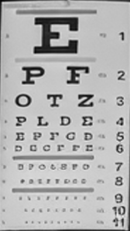 Eye chart, Fotello before ReFine
